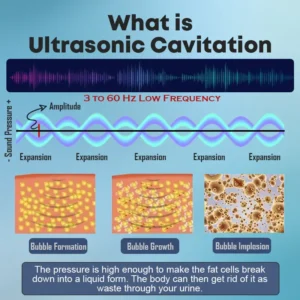 QIAWI™ Ultrasonic Fat Blasting & Far Infrared Blood Sugar Balancing Detox Wristband